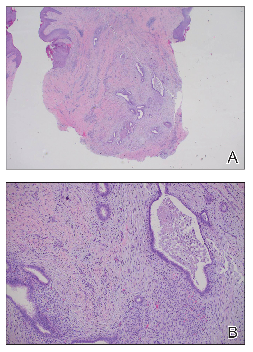 CT116004123-Fig1_AB
