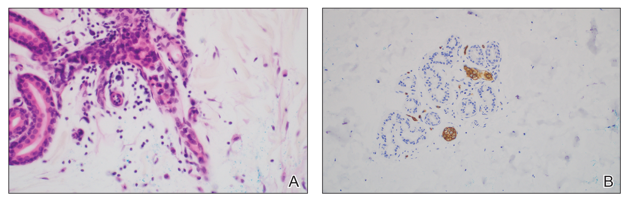 CT116004143-Fig1_AB