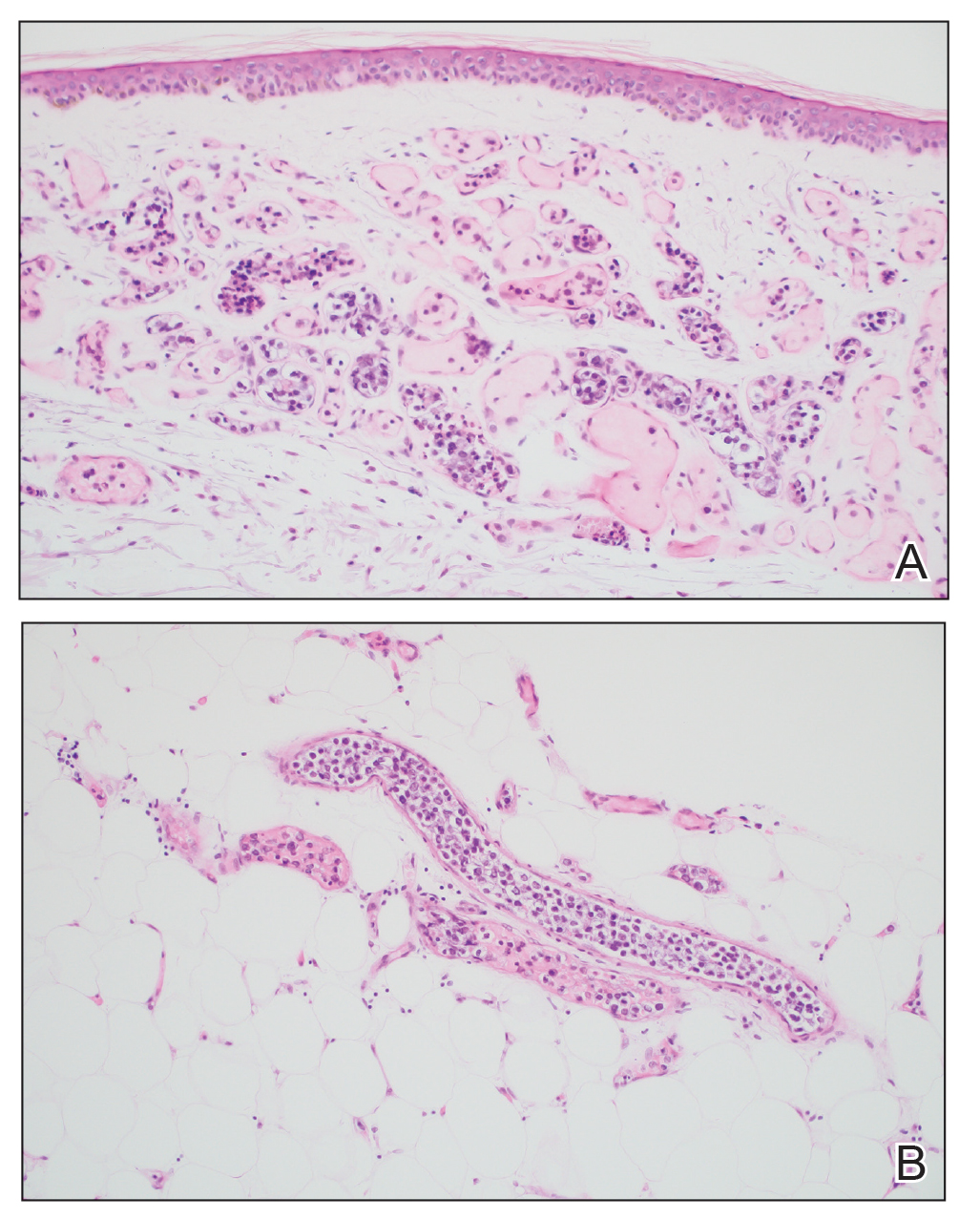 CT116004143-eFig3_AB