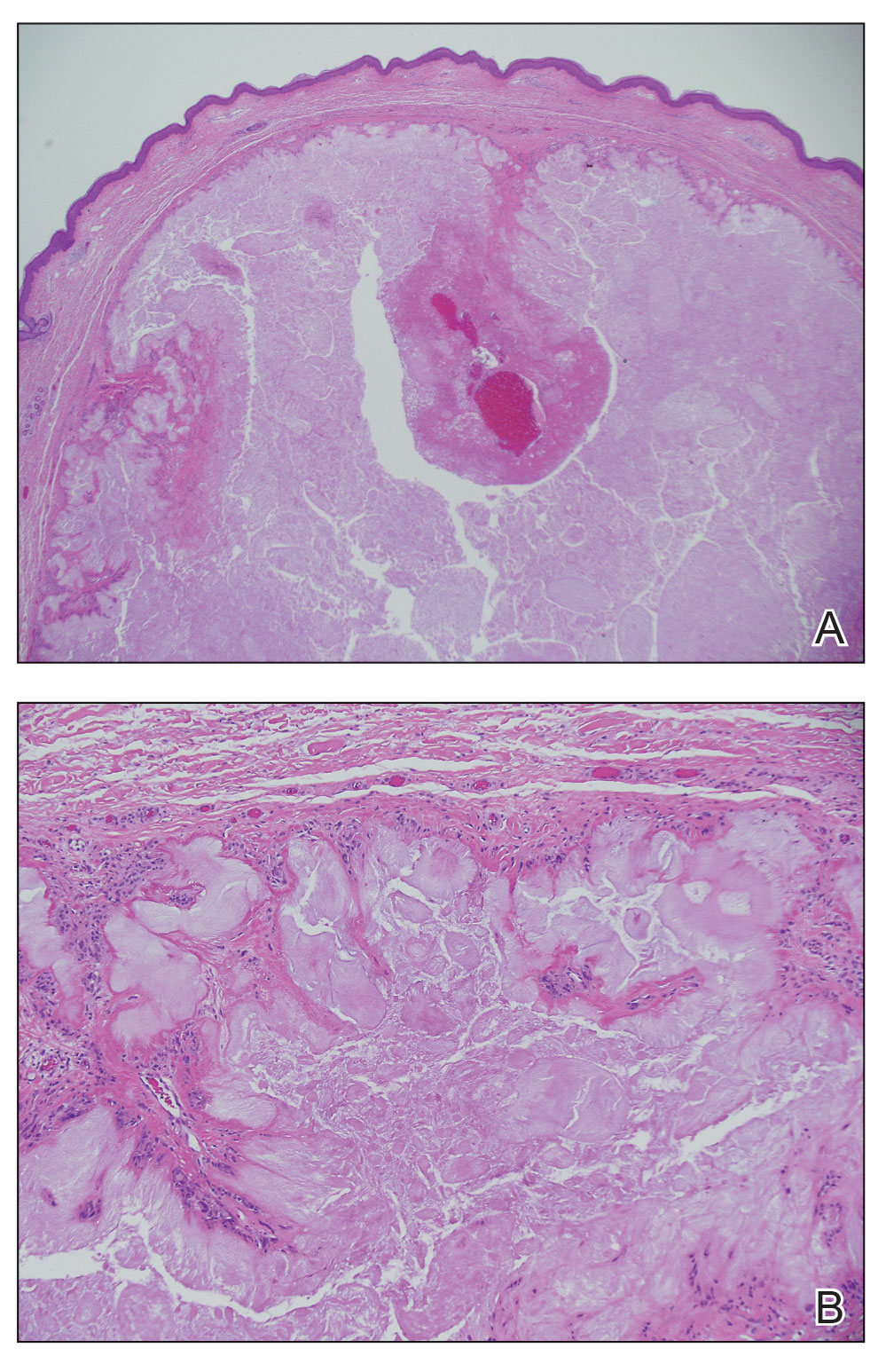 CT116005164-eFig2-AB