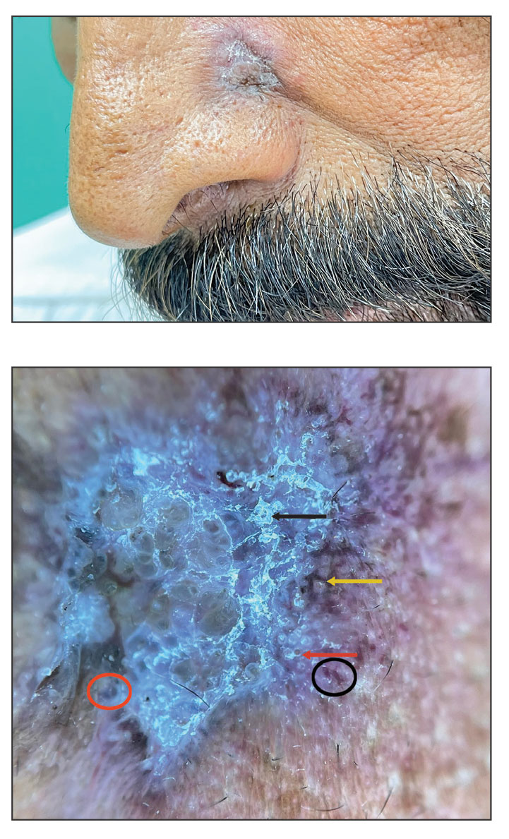 CT116005179-Quiz_top_bottom