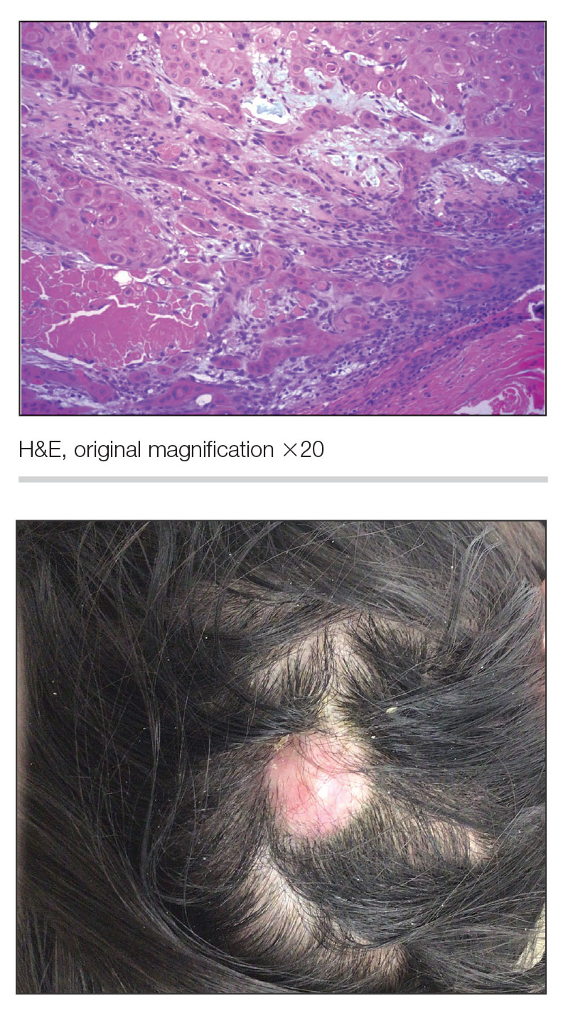 CT116006215-Quiz-top-bottom