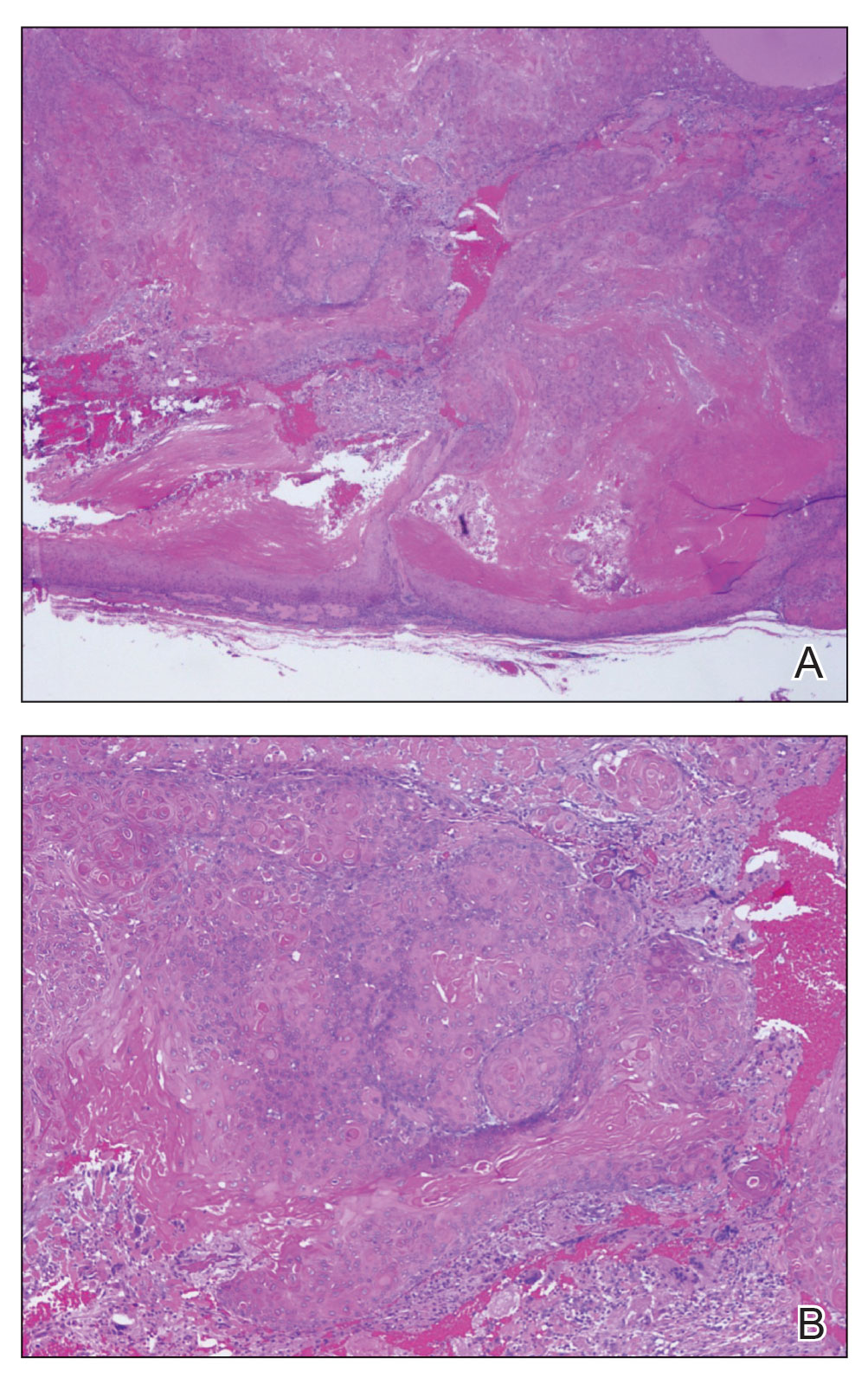 CT116006215-eFig-1_AB