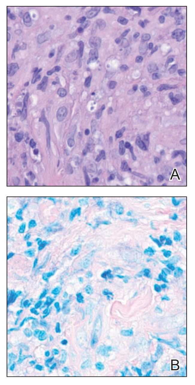 CT117001039_e-Fig2_AB