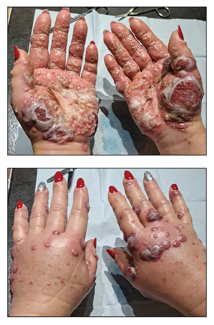 CT117001045_e-Quiz_top_bottom