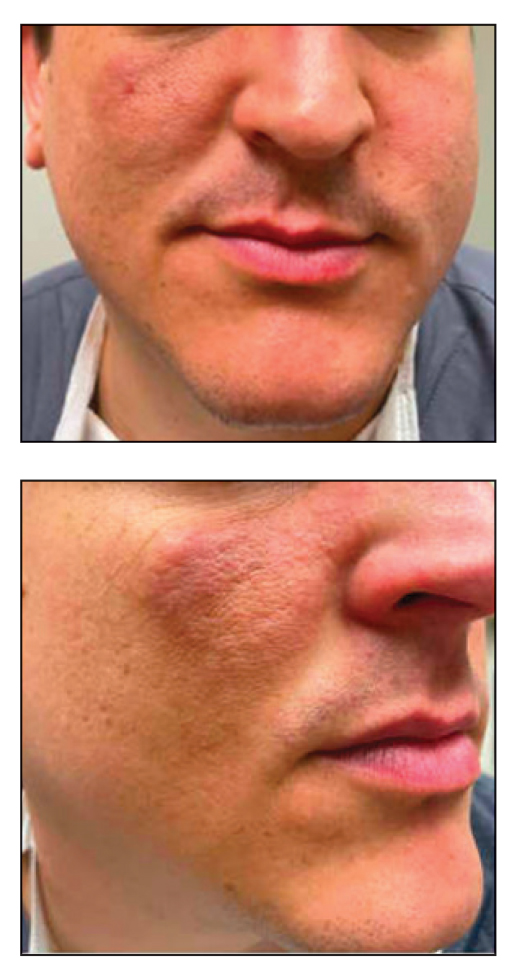 CT117001052_e-Quiz-top_bottom