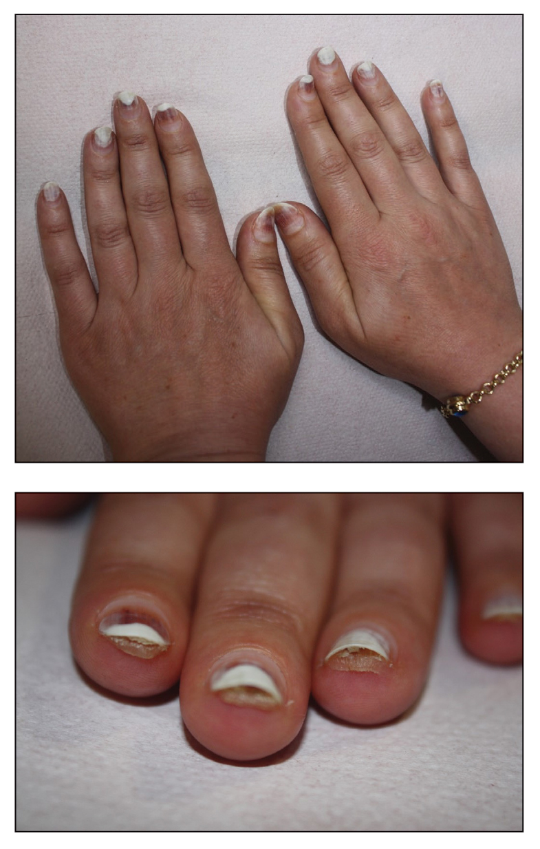 CT117002007_e-Quiz_top_bottom