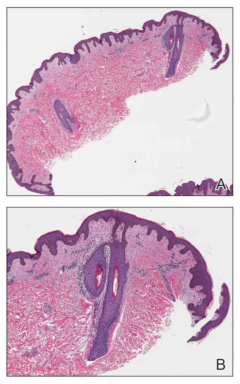 CT117002009_e-Fig1_AB