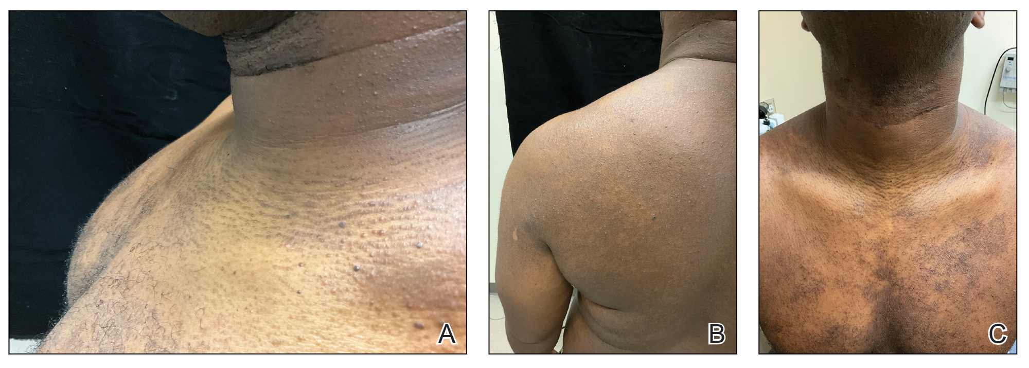 CT117002009_e-Fig2_ABC