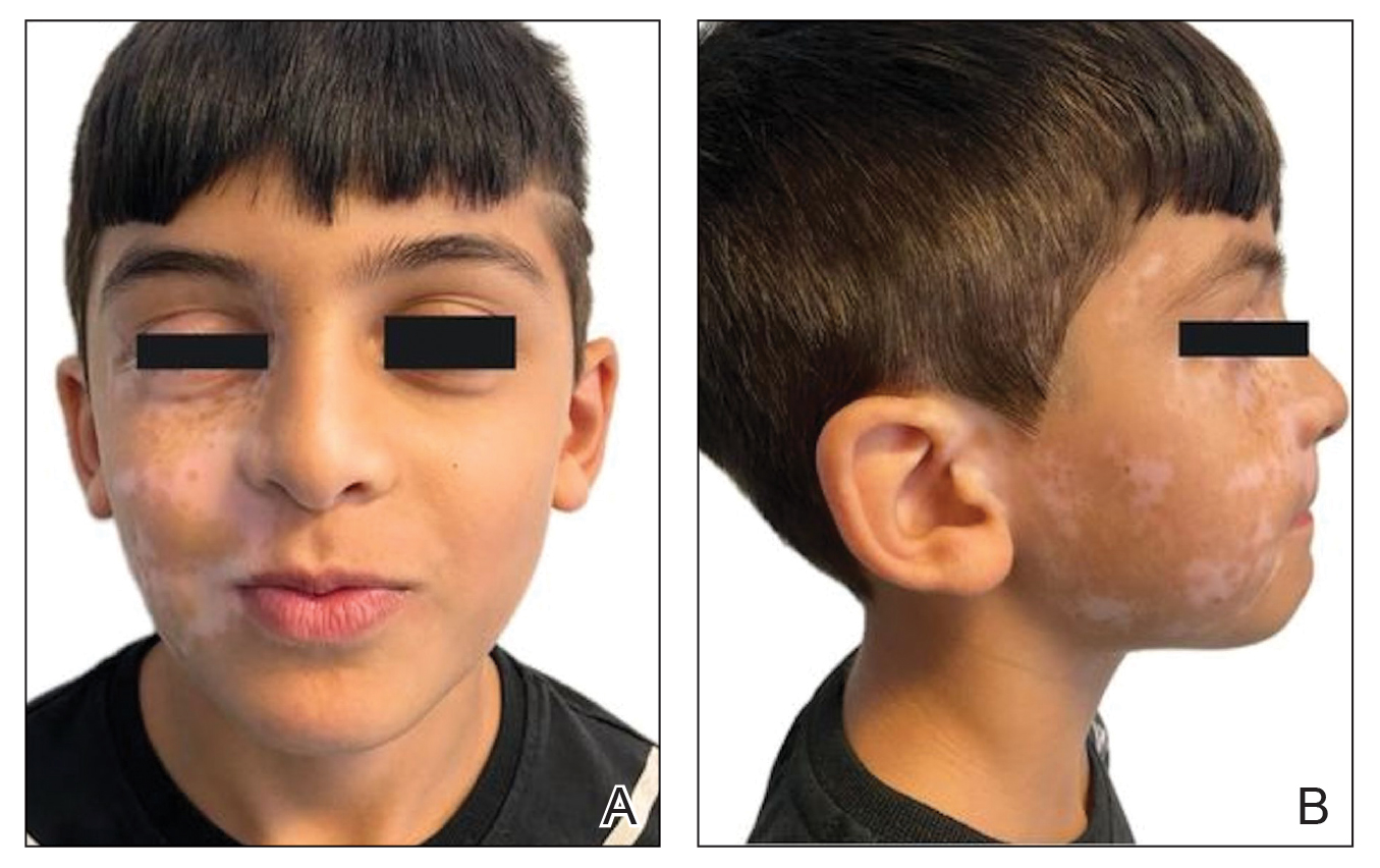 CT117002014_e-Fig1_AB