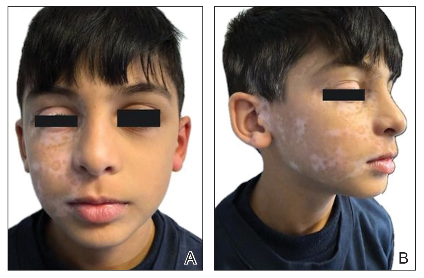 CT117002014_e-Fig2_AB