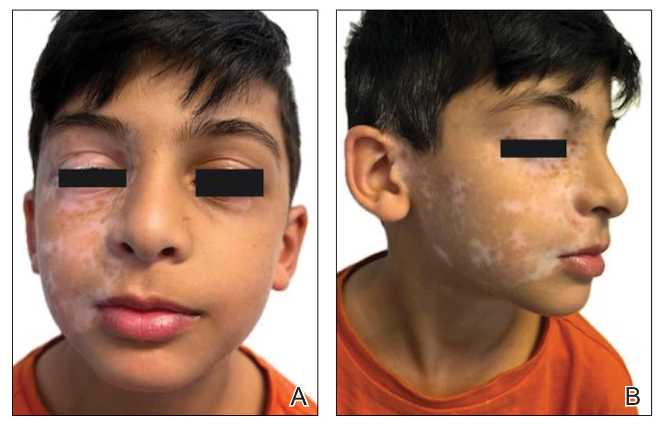 CT117002014_e-Fig3_AB