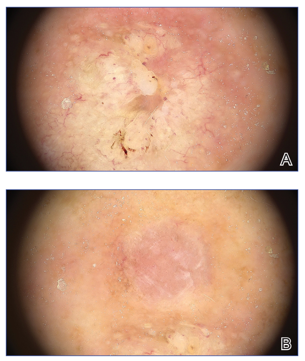 CT117002019_e-Fig1_AB