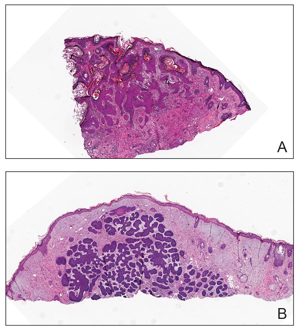CT117002019_e-Fig2_AB