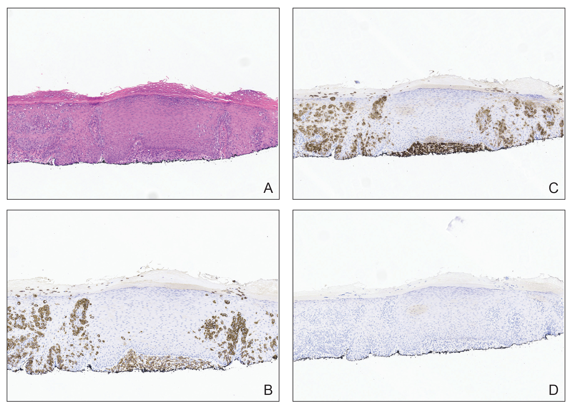 CT117003017_e-Fig2_ABCD