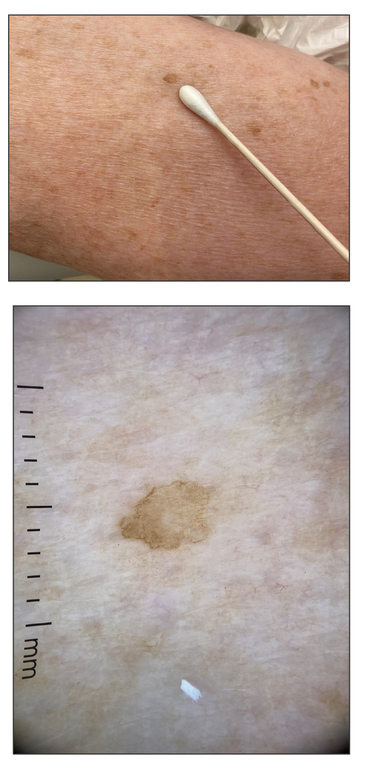 CT117003092-Quiz_top_bottom