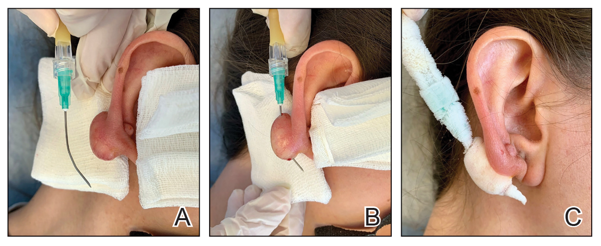 CT117003096-Fig2_ABC