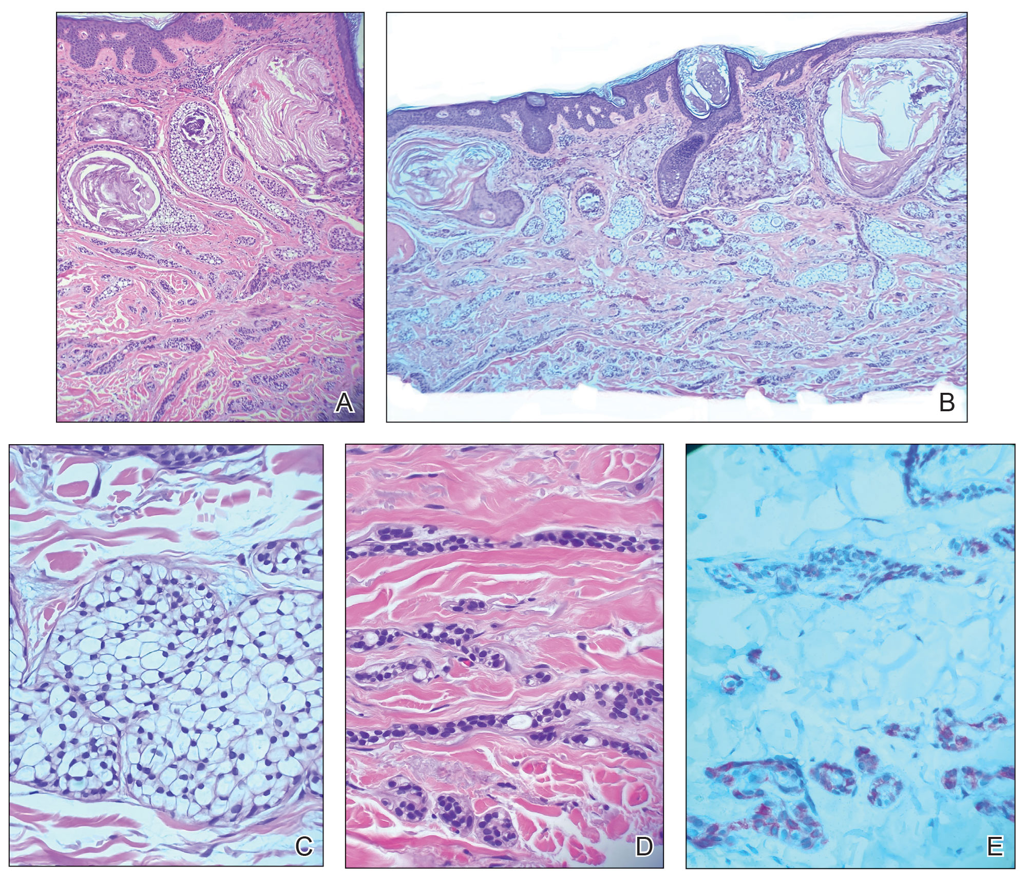 CT117004023_e-Fig2_ABCDE