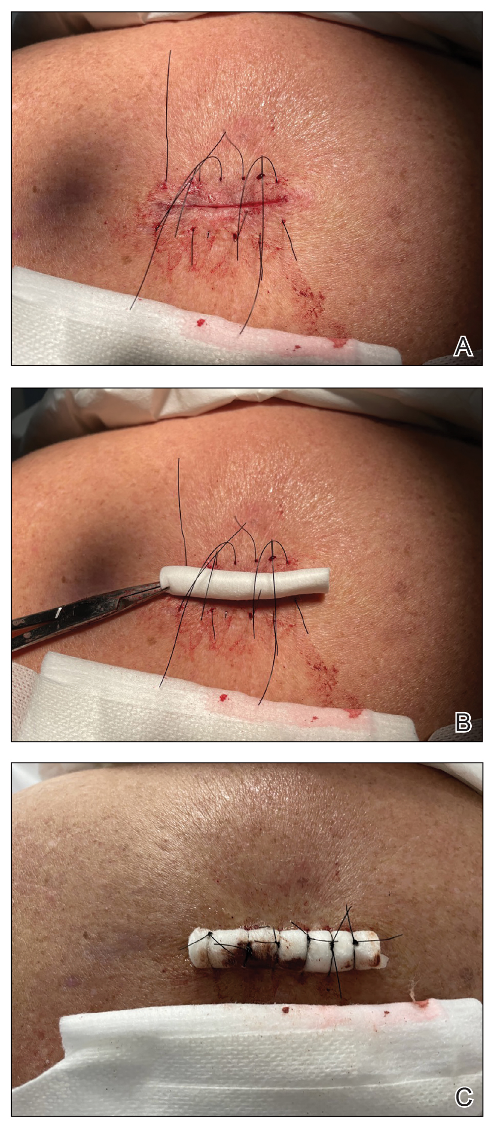 CT117004123-eFig1_ABC