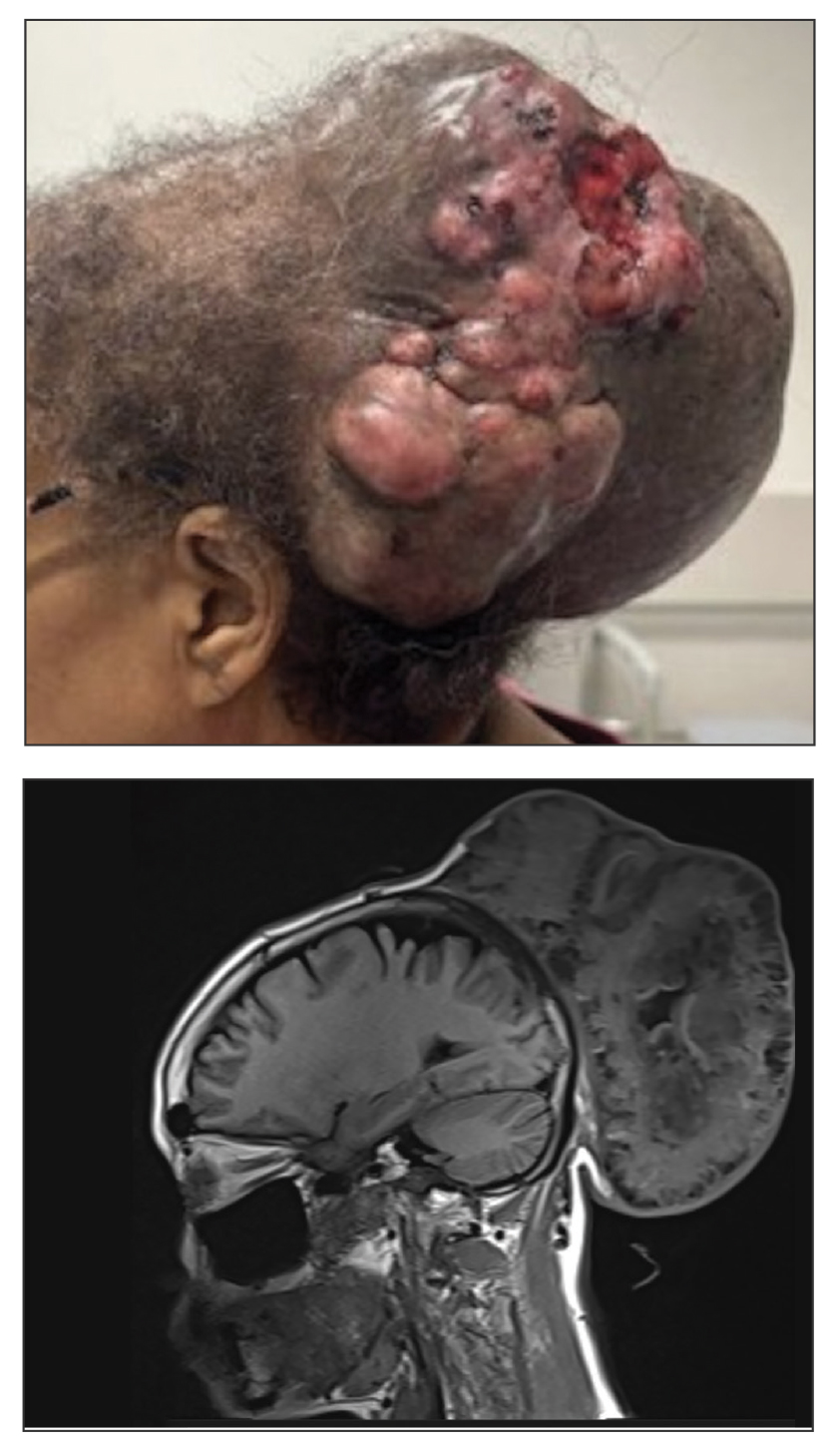 CT117005142-Quiz_top_bottom