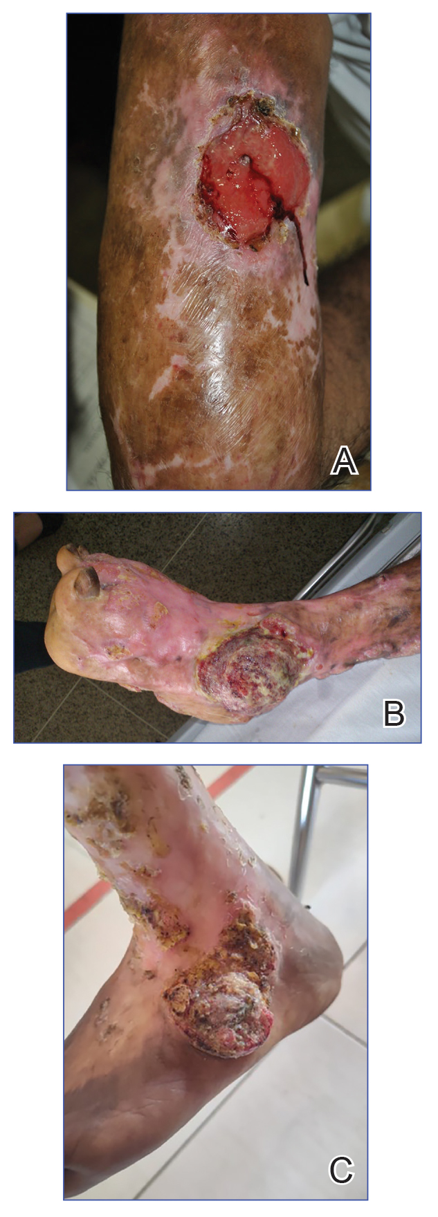 CT117005143-Fig-ABC