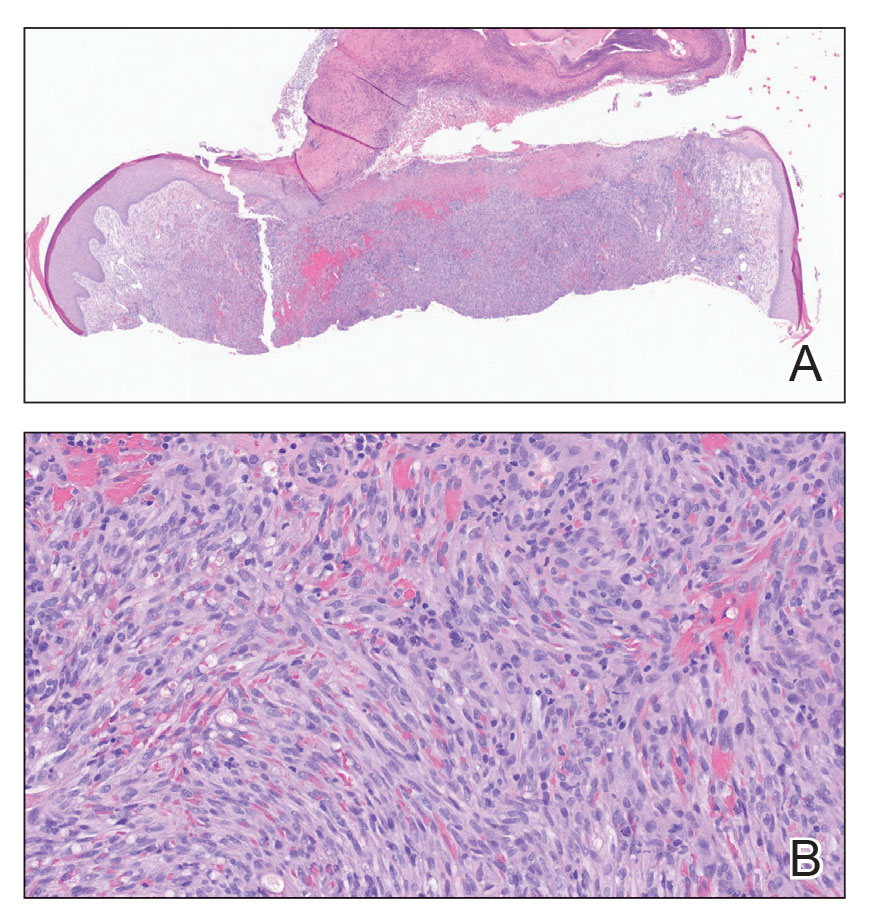 CT117006177-fig1_AB