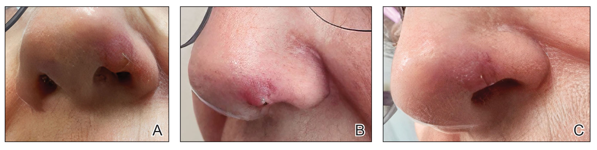 CT117006191-Fig4_ABC
