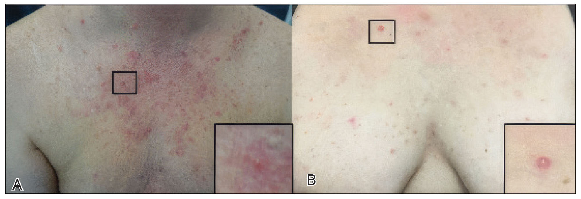 CT118001006-Fig1_AB