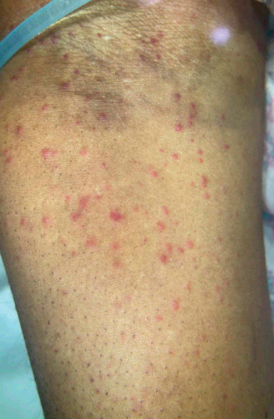 Choi-HC-2