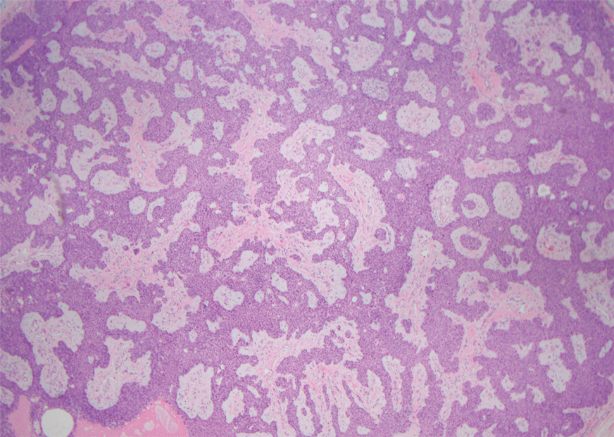 Ezenwa-3