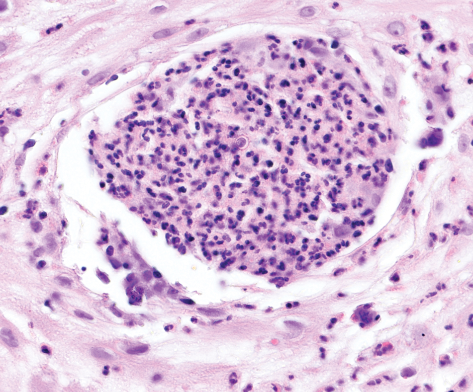 Han-Dermpath-1