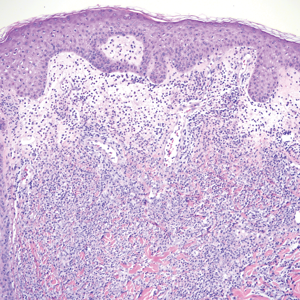 Han-Dermpath-4