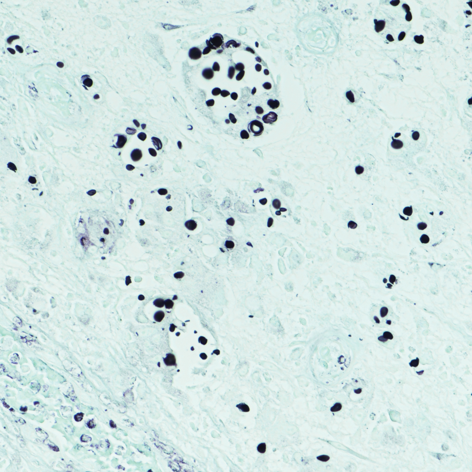 Han-Dermpath-Quiz-bottom