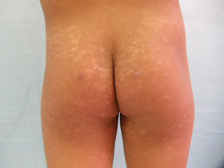Herrera_Ocampo_Fig1