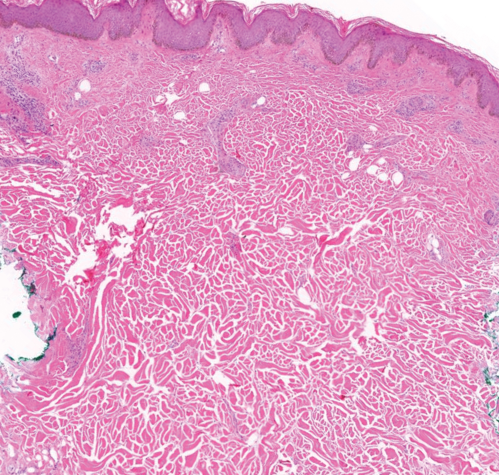 Hill-dermpath-2