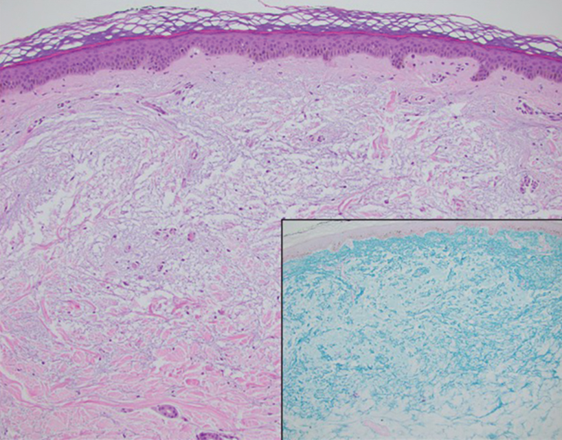 Hill-dermpath-Quiz-top