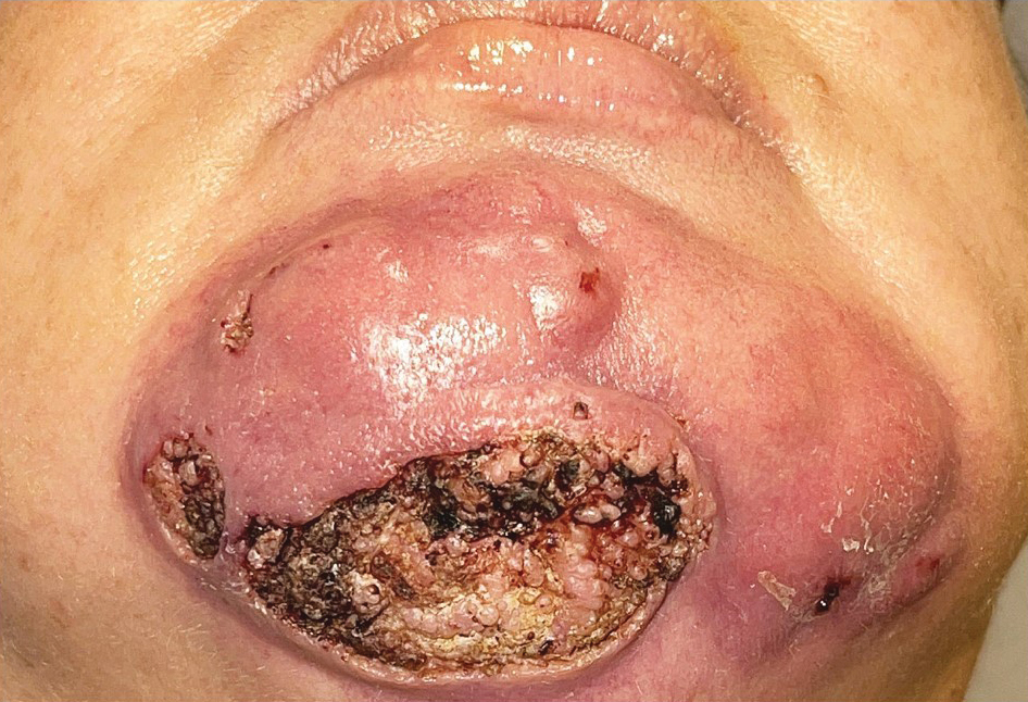 Huang-Facial-1