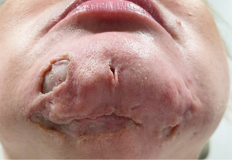 Huang-Facial-5