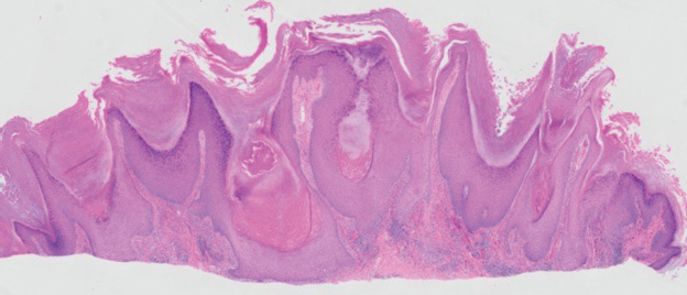 Sattele-1