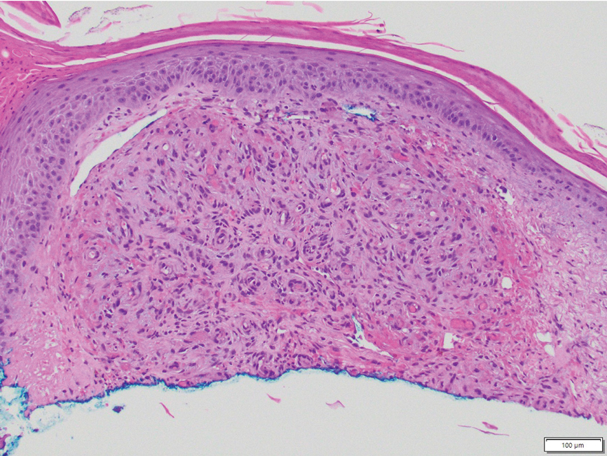 Xu-eFig2