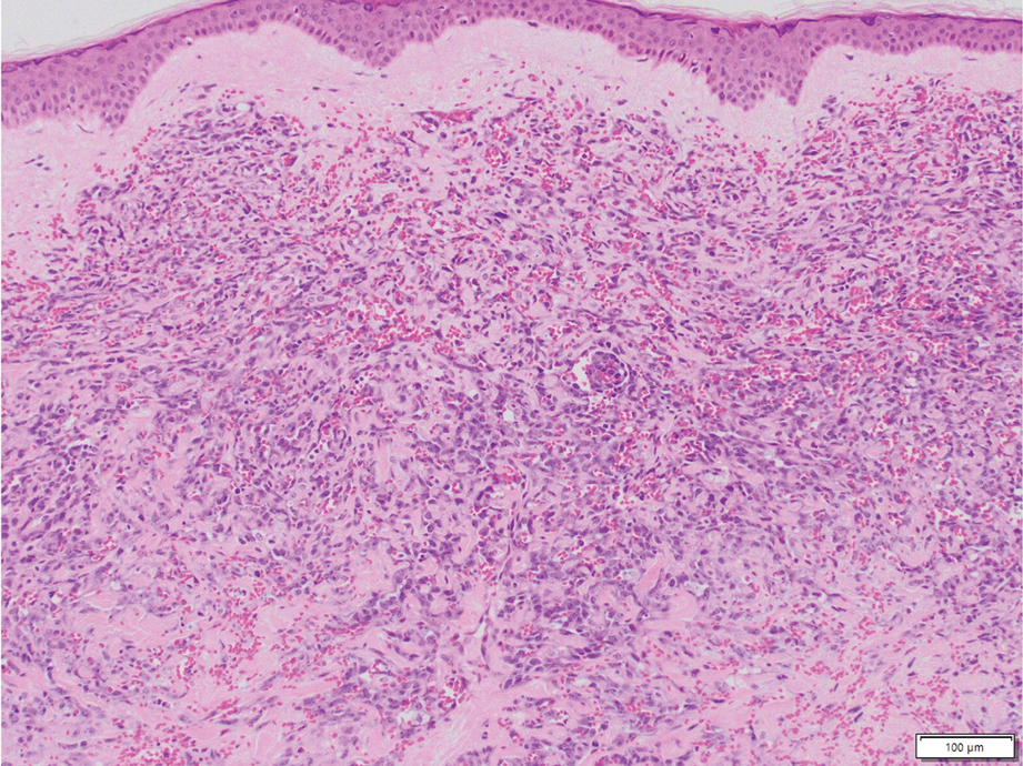 Xu-eFig3