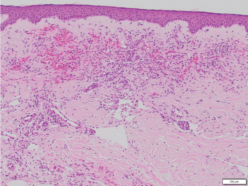Xu-eFig4