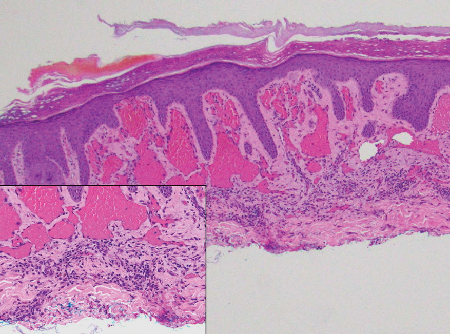 Xu-eFig5
