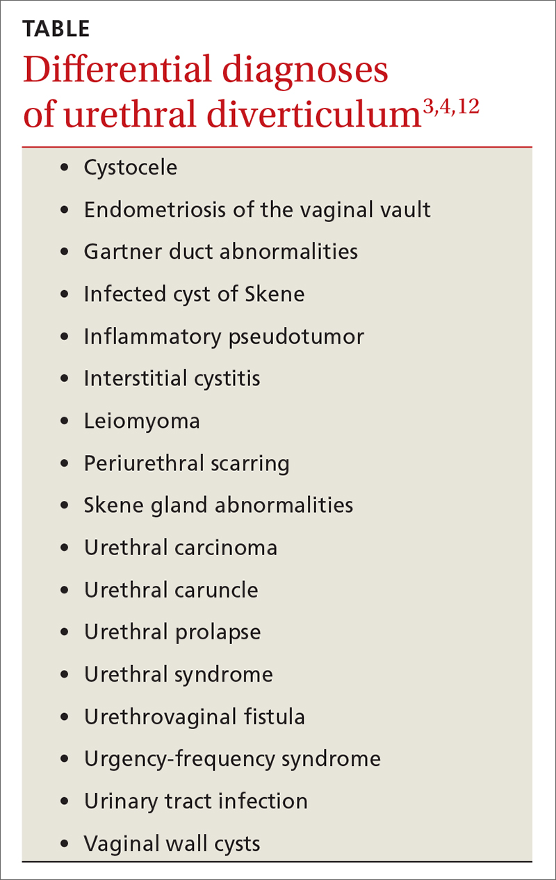 Differential diagnoses of urethral diverticulum