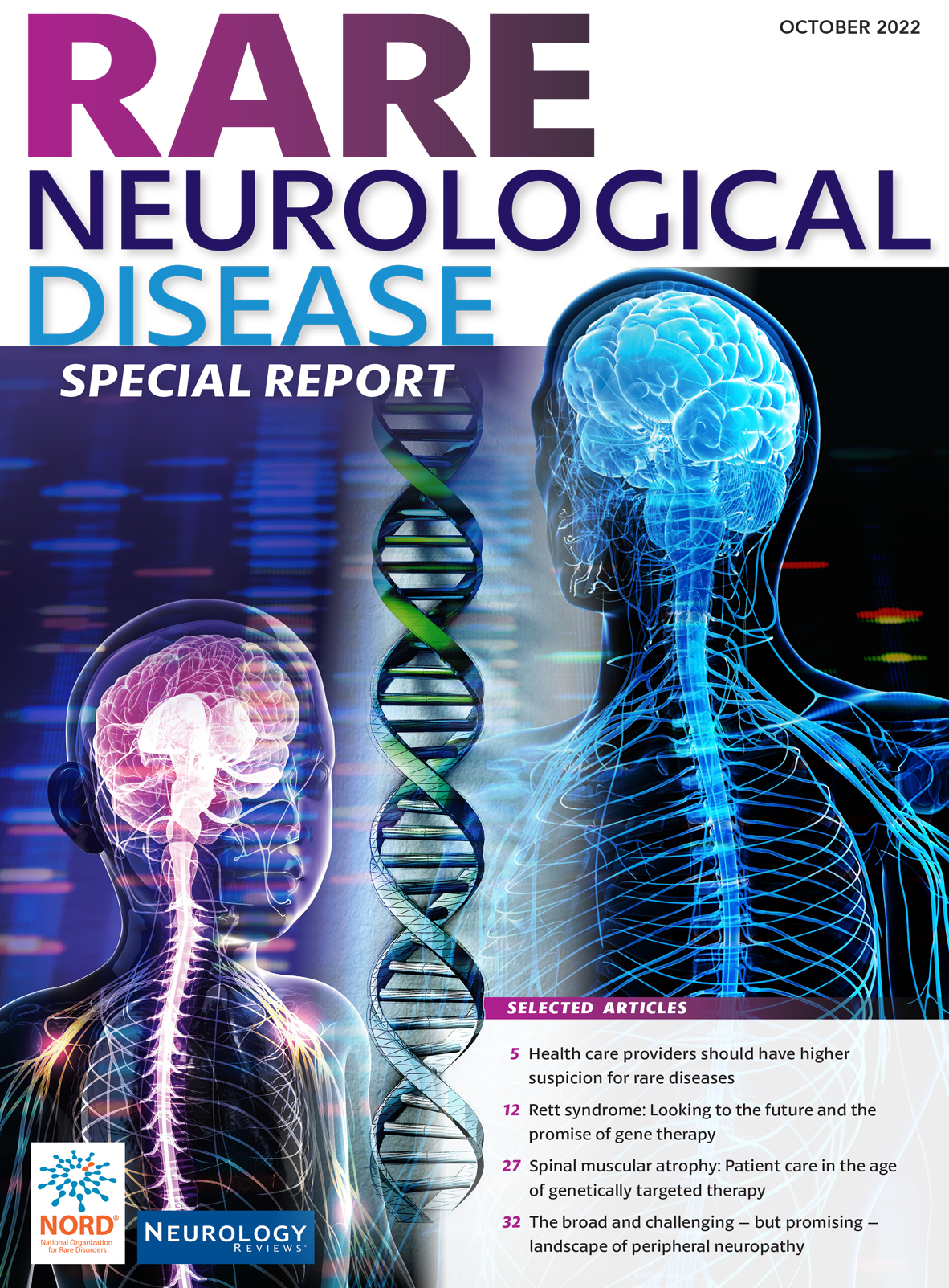 2022 Rare Neurological Disease Special Report MDedge Neurology