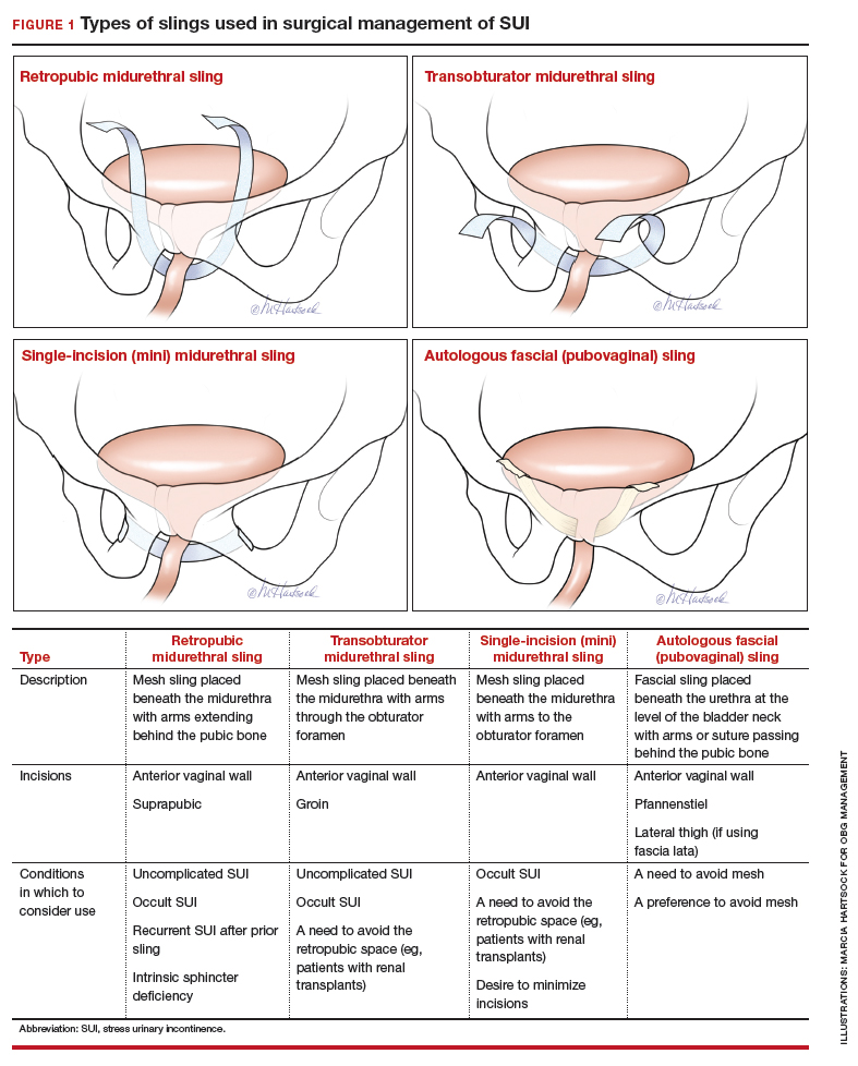 op tijd mat Oven Using slings for the surgical management of urinary incontinence: A safe,  effective, evidence-based approach | MDedge ObGyn