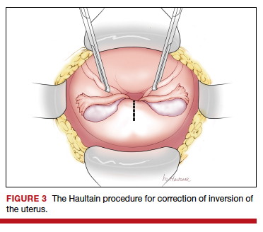 Abnormal uterine action- Clinical Teaching Plan use in OBG submission. | PDF