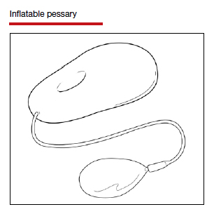Inflatable pessary