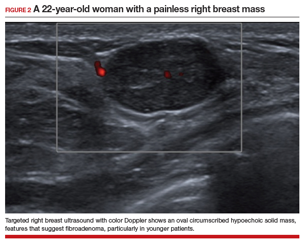 Evaluating patients with breast concerns: Lump, pain, and mastitis