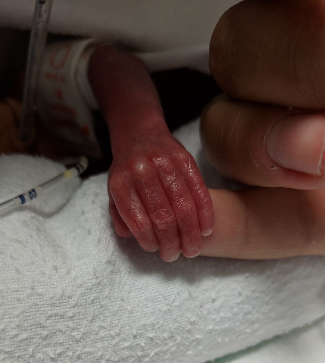 premature baby in hand